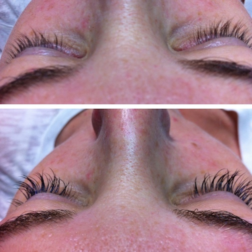 Eyelash Extensions Corrective work | Before and After 3